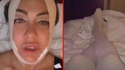 Yeliz Yeşilmen, estetik ameliyatı geçirdi