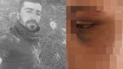 Tunceli'de dini nikahlı eşine 6 ay boyunca işkence yaptı
