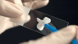Kadınlarda en önemli tarama: Smear testi nedir