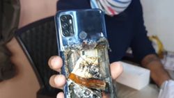 Hindistan'da Oppo A53'ü patlayan kullanıcı yaralandı