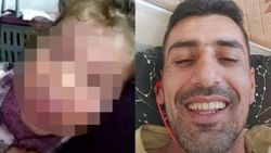 Kayseri'de çocuğu işkence gören babanın açıklamaları