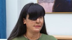 Berfin'in hikayesi herkesi ağlattı! Berfin Özek kimdir? Paylaş Benimle Berfin Özek'in biyografisi