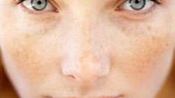 Yaz aylarında cilt sağlığı için 5 vitamin