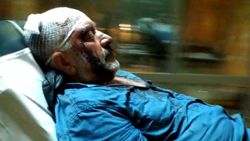 Adıyaman'da taş ve sopalarla hayvan otlatma kavgası yaptılar