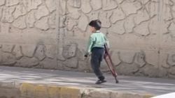 Mardin’de, 5 yaşındaki Muhammed için kaymakamlık protez sipariş etti
