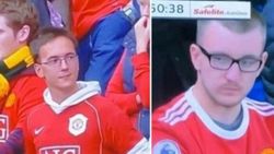 M. United taraftarı saçının dökülmesinden kulübü sorumlu tuttu