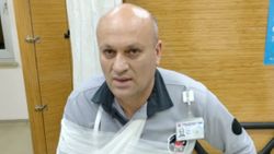 Çorum'da kavgayı ayıran güvenlik görevlisinin kolu çıktı