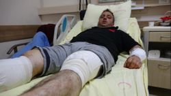 Tokat'ta ayı saldırısına uğradı, güreşerek kurtuldu