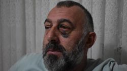 Kocaeli'de otobüs şoförleri yolcuyu darbetti