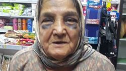 Kocaeli’de eşi tarafından dövülen 73 yaşındaki kadın, konukevine yerleştirildi