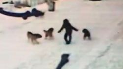 Kars'ta bir çocuk 7 köpeğin saldırısından cesaretiyle kurtuldu