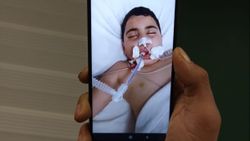 Gaziantep'te ekmek almak için evden çıktı, komalık oldu