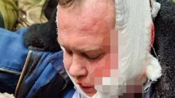 Ukrayna’da düşürülen uçağın pilotu halk yakaladı