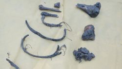 2006 yılında kayıp olarak aranan kadının kemikleri su kuyusunda bulundu