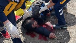 Düzce'de otomobile çarpan motosikletli, yola savruldu