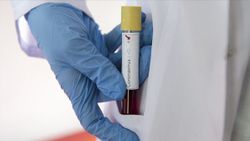  Mutaston, koronavirüsü azalttı