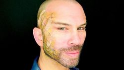 Estetik yaptıran Berksan, ortaya çıktı