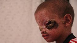  Ailemi görmek istiyorum