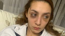 Gaziosmanpaşa'da eşofman yüzünden terk edilen kadın darbedildi