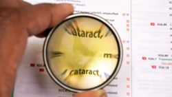 Kataraktın 7 sessiz belirtisi