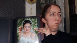 Giresunlu hemşire ameliyat sonrası felç geçirdi, kafatası kayboldu