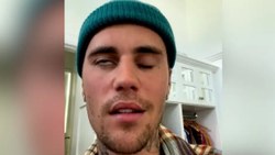 Justin Bieber, yüz felcine yakalandı