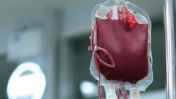 Laboratuvar kanı ilk kez bir insana nakledildi