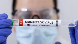 DSÖ’den maymun çiçeği virüsünün adını değiştirecek hamle: Mpox olacak