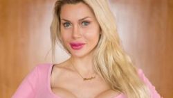 Barbie Pixee Fox 18'inci ameliyatı için İstanbul'da