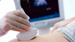 Hollanda'da 19 çocuğun babası tüp bebek doktoru çıktı