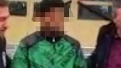 Tartıştığı sevgilisinin yanağını bıçakla kesti