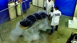 Kanserden ölen kızını dondurdu