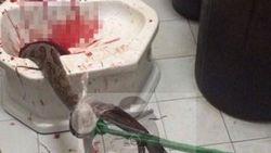 Tuvalette pitonun saldırısına uğradı
