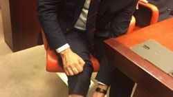 Eren Erdem AK Partili vekili bacağından ısırdı