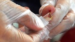 Kistik fibrozise tarama testli çözüm