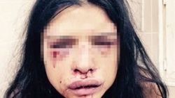 Onur Özbizerdik'in dövdüğü sevgilisi konuştu: Haklıydı