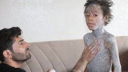 Balık hastalığına yakalanan Melih yardım bekliyor