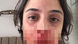 Hazım Körmükçü nişanlısını dövdü