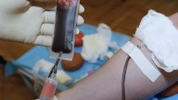 Türkiye'de AIDS hastasında artış