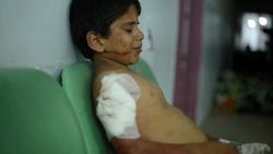 PKK/PYD'den Mare ilçesine saldırı