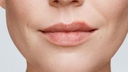 Herpes simplex nedir