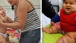 Kolombiyalı 8 aylık bebek 20 kiloya ulaştı