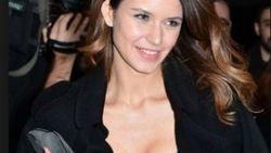 Beren Saat'in şortunun fermuarı bozuldu