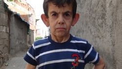 Yaşlanma hastalığına yakalanan çocuk yardım bekliyor