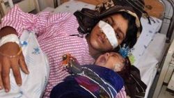 Eşi tarafından burnu kesilen kadın Türkiye'ye geliyor