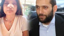 Onur Özbizerdik hakkındaki uzaklaştırma kaldırıldı