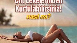 Cildinizdeki lekelerden çok mu sıkıldınız