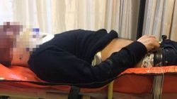 Samsun'da 'Sesin güzel değil' diyen adam hastanelik oldu