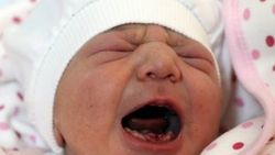 Amasya'da dokuz dişli bebek dünyaya geldi
