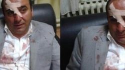 AK Partili Kadir Dede saldırıya uğradı